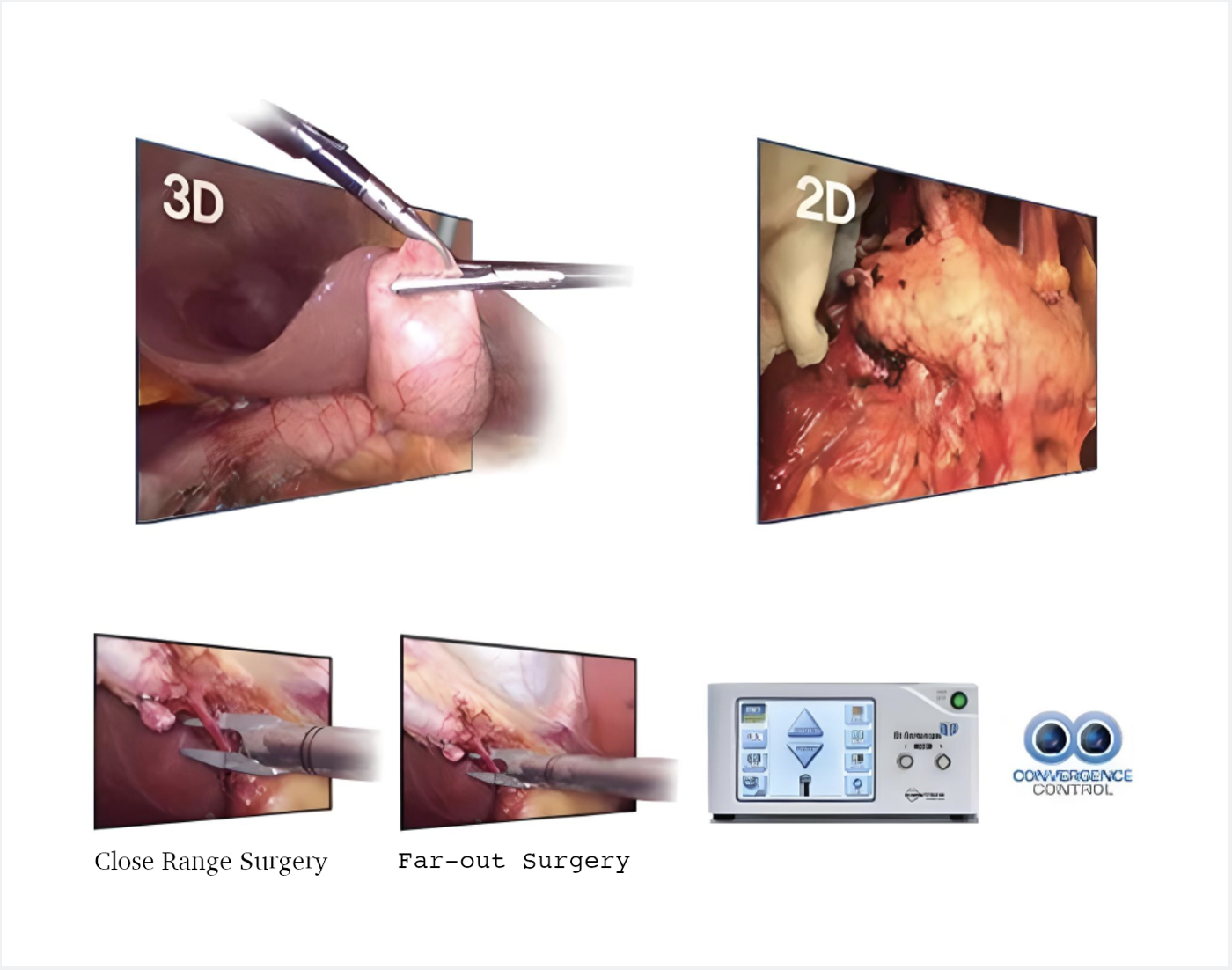 Dr. Camscope 3D Laparoscopy System by MEDILIFE — image 2