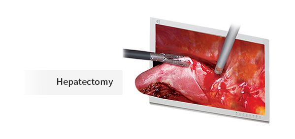 Dr. Camscope 3D Laparoscopy System by MEDILIFE — image 7