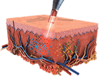 PICOCARE Majesty Nd:YAG Laser by MEDILIFE — image 5