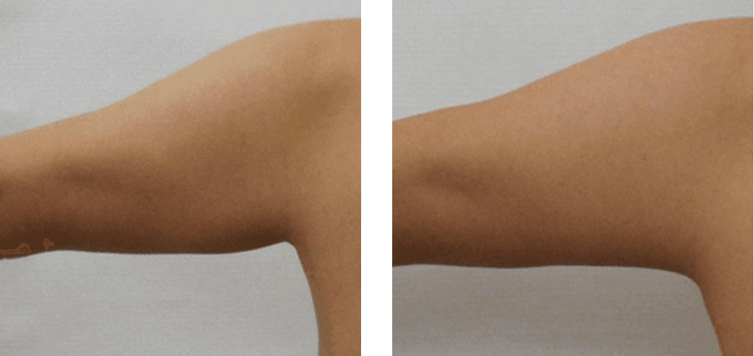 Powershape 2 by MEDILIFE — image 7