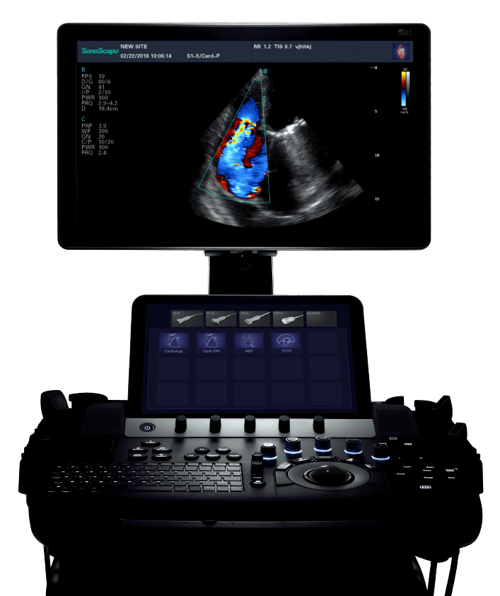 Ultrasound System S50 by MEDILIFE — image 2