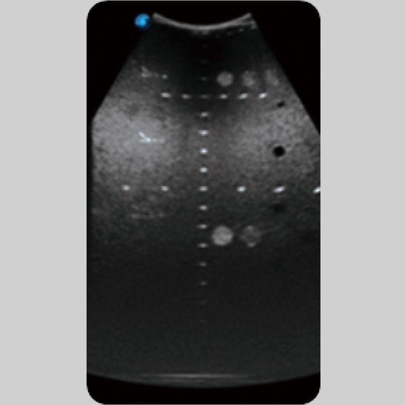 Ultrasound System S50 by MEDILIFE — image 5