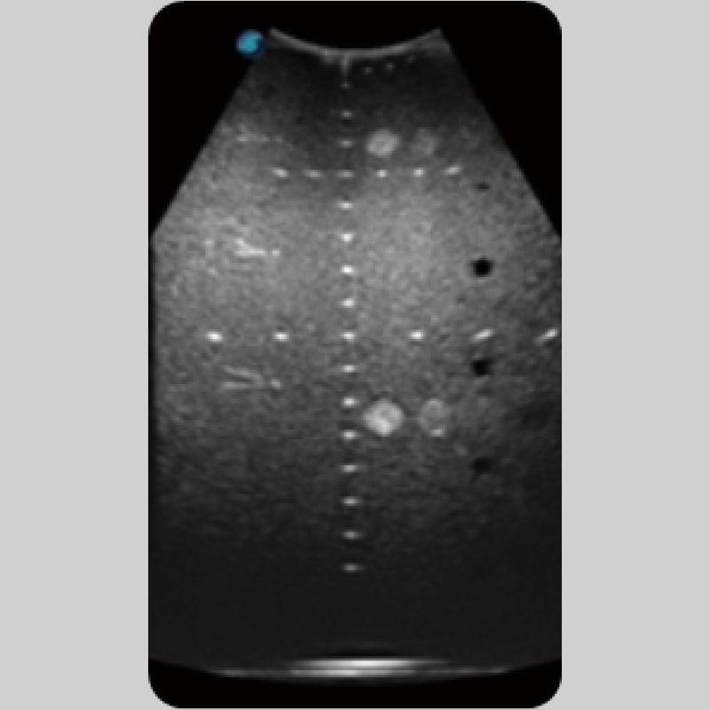 Ultrasound System S50 by MEDILIFE — image 6