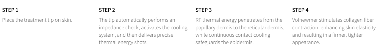Volnewmer by MEDILIFE — image 4