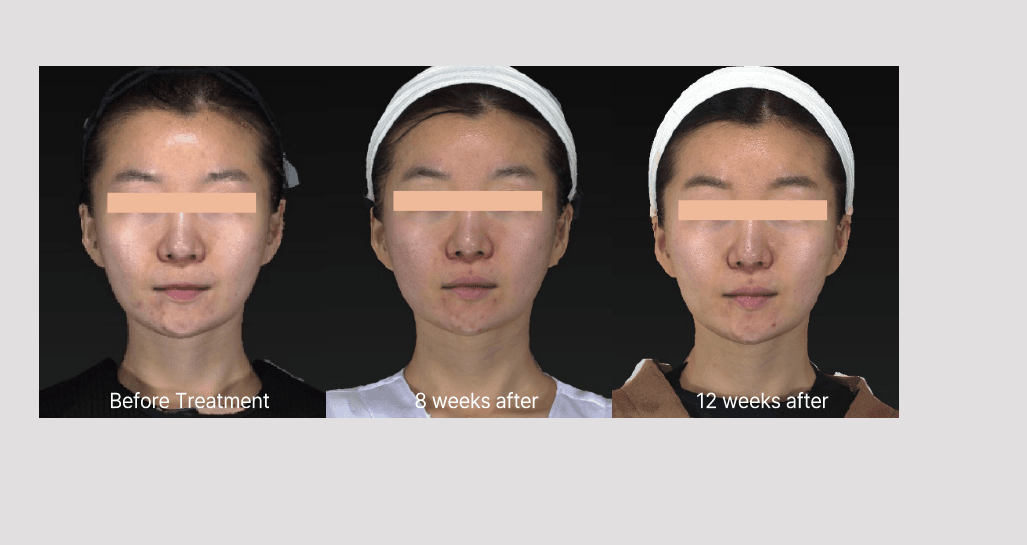 Volnewmer by MEDILIFE — image 7