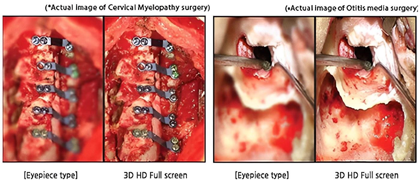 VOMS-100 3D Operating Microscope (Ophthalmology) by MEDILIFE — image 2
