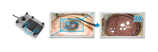 VOMS-100 3D Operating Microscope (Ophthalmology) by MEDILIFE — image 6