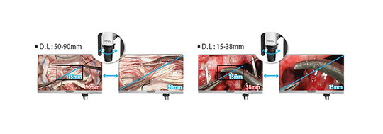 VOMS-101 3D Operating Microscope (Spine / Brain) by MEDILIFE — image 6